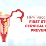 Human Papillomavirus (HPV), Cervical Cancer