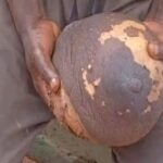 Police arrest 25-year-old Samuel Eze in Anambra with a fresh female breast