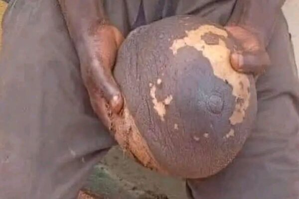 Police arrest 25-year-old Samuel Eze in Anambra with a fresh female breast